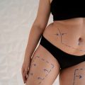 Understanding Awake Liposuction: A Modern Approach to Body Contouring
